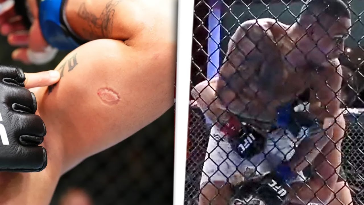UN LUCHADOR DE UFC MUERDE SALVAJEMENTE A SU RIVAL EN PLENO COMBATE Y ES DESPEDIDO – ¡Lo nunca visto!