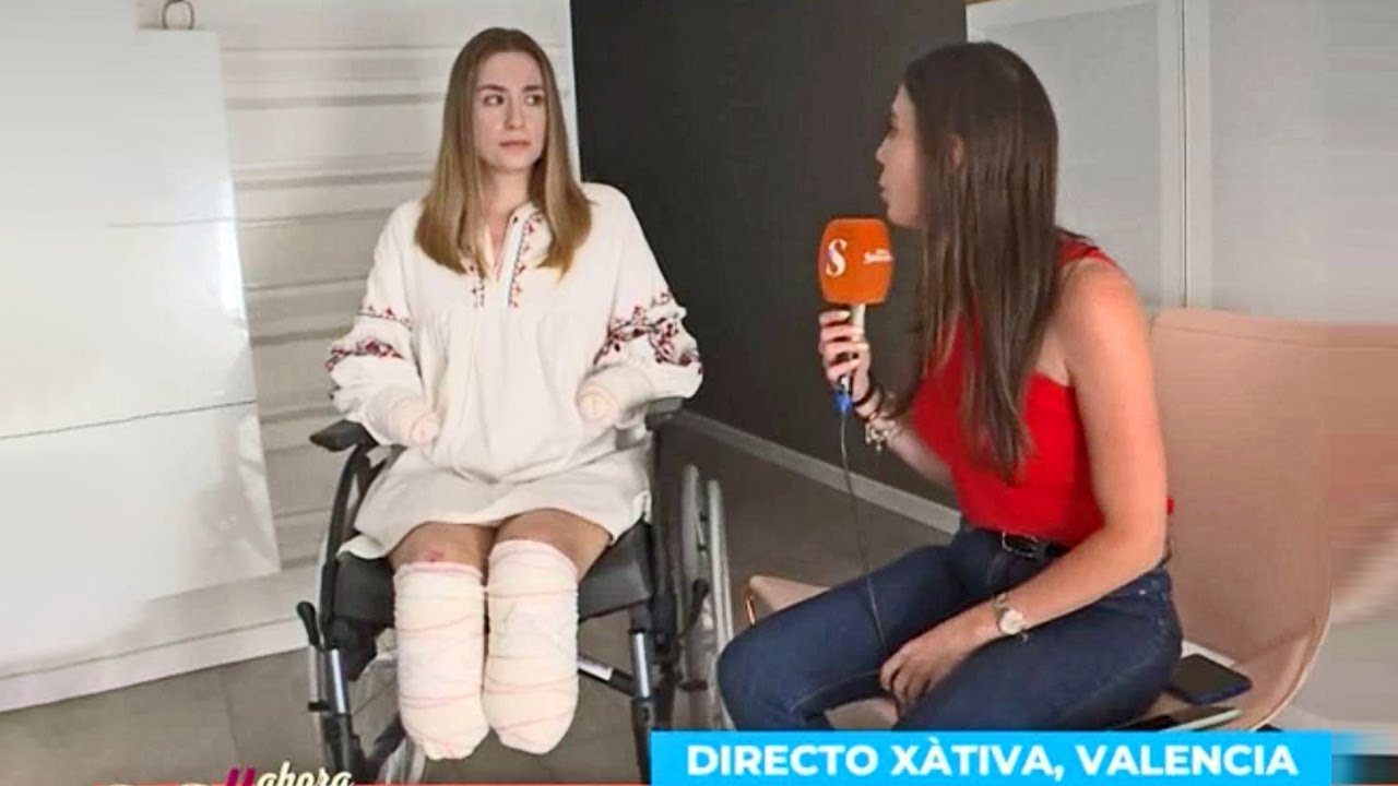 UNA CHICA DE 25 AÑOS PIERDE LAS MANOS Y LOS PIES REPENTINAMENTE POR CULPA DE UNA BACTERIA